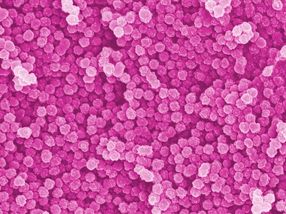 Nanoplastics – an underestimated problem?