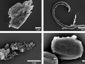 Learning from dust: health risks of microparticles