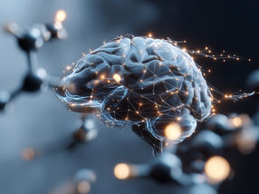 Predicting the Kinetic Energy of Molecular Quantum Systems Using Artificial Intelligence